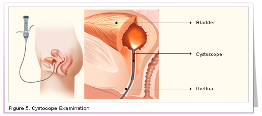 Bladder